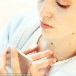 Mang hơn 10 nốt ruồi trên tay có khả năng mắc ung thư cao ?